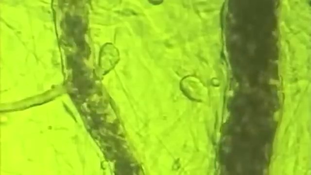 The BEMER Effect, under the microscope. — poster